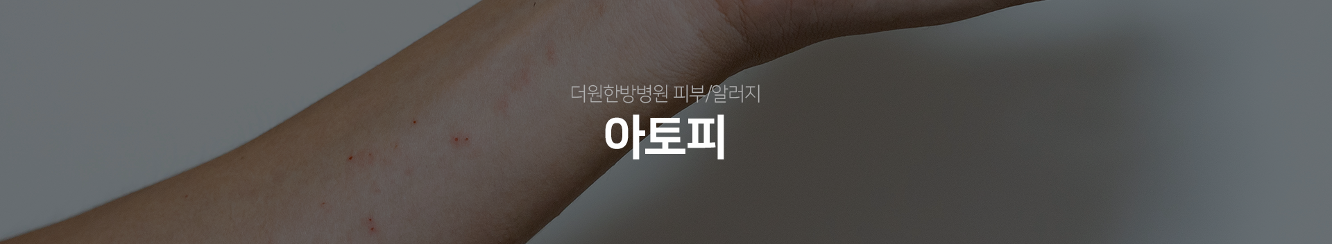 더원한방병원-피부/알러지-아토피