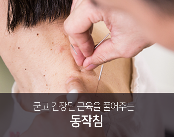 굳고-긴장된-근육을-풀어주는-동작침