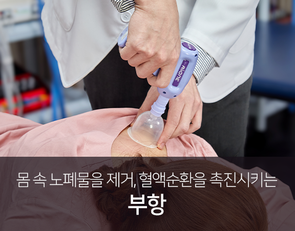 몸속-노폐물을-제거-혈액순환을-촉진시키는-부항