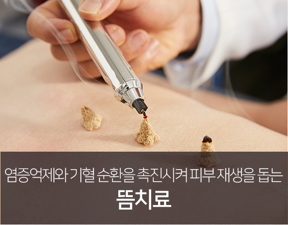 염증-억제와-기혈-순환을-촉진시켜-피부-재생을-돕는-뜸-치료