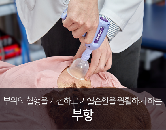 부위의-혈행을-개선하고-기혈순환을-원활하게-하는-부항치료