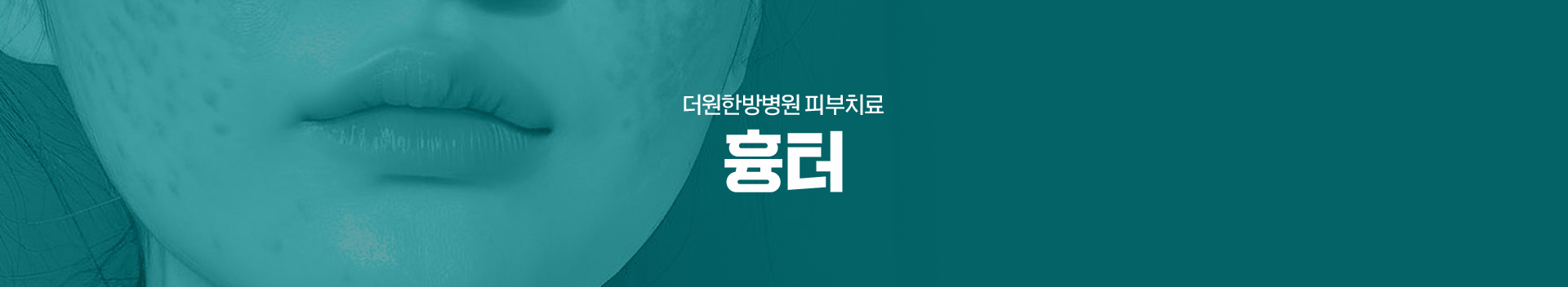 더원한방병원-피부치료