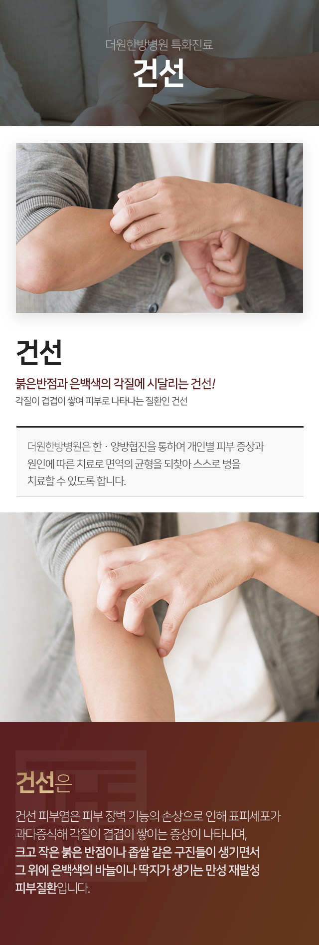 더원한방병원-특화진료-건선-건선-피부염은-피부-장벽-기능의-손상으로-인해-표피세포가-과다증식해-각질이-겹겹이-쌓이는-증상이-나타나며-크고-작은-붉은-반점이나-좁쌀-같은-구진들이-생기면서-그-위에-은백색의-바늘이나-딱지가-생기는-만성-재발성-피부질환입니다