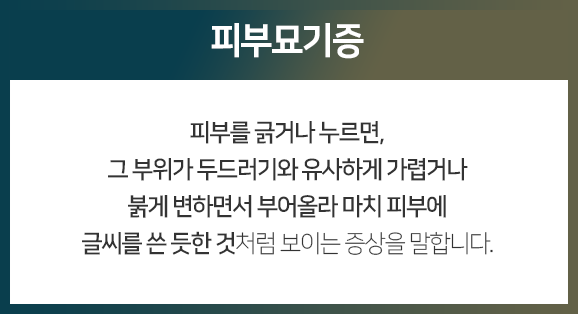 피부묘기증-피부를-긁거나-누르면-그-부위가-두드러기와-유사하게-가렵거나-붉게-변하면서-부어올라-마치-피부에-글씨를-쓴-듯한-것처럼-보이는-증상을-말합니다