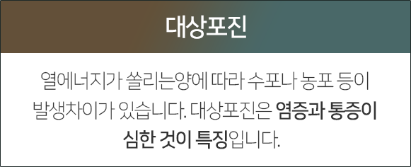 대상포진-열에너지가-쏠리는-양에-따라-수포나-농포-등이-발생-차이가-있습니다-대상포진은-염증과-통증이-심한-것이-특징입니다